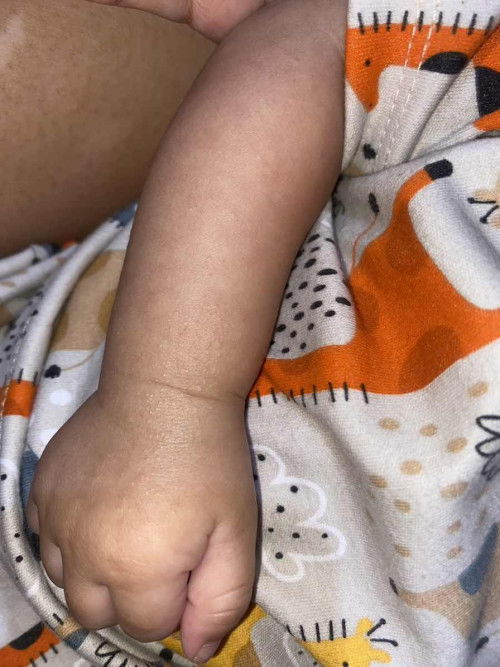 Bintik merah kecil di tangan