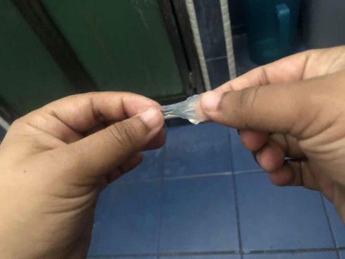 Mucus Plug atau keputihan ?