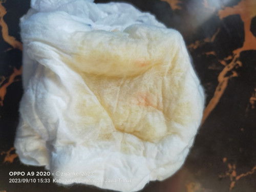 Noda kemerahan di Pampers