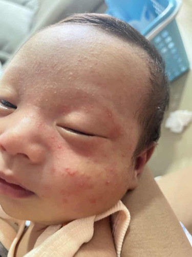 #ขอคำแนะนำหน่อยค่ะแม่ๆ