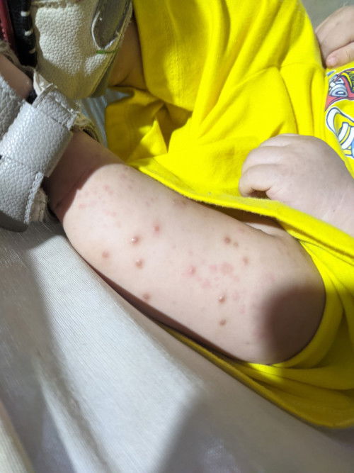 Mga mii,pa help namn oh kung ano ba tong tumutubo sa baby ko na katikati?