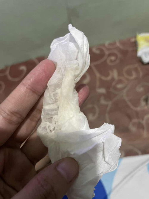 Ini warna Air Ketuban atau bukan ya bun?