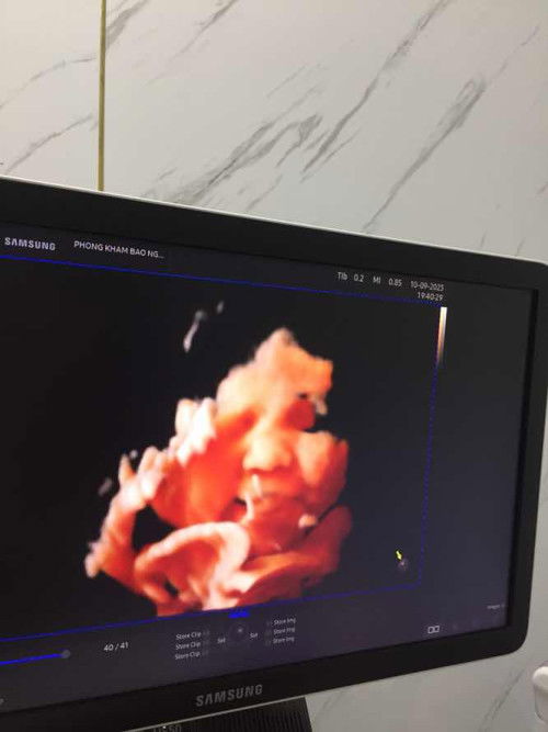 thị miu😍😍🦝😻