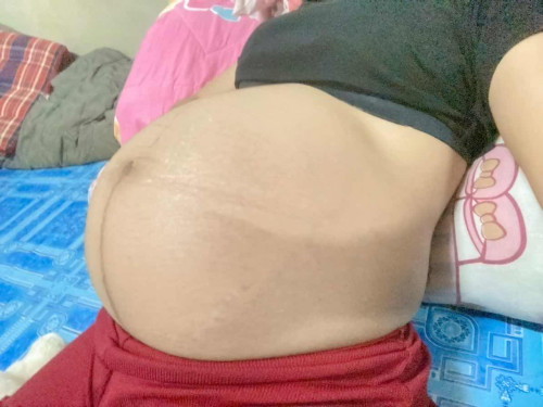 34 สัปดาห์ กำหนด 23ตุลา
แต่กลัวแอบเเตกก่อน🥹