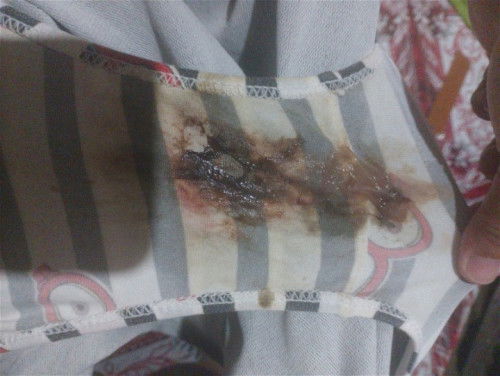 38 weeks and 6 days due date ko 20