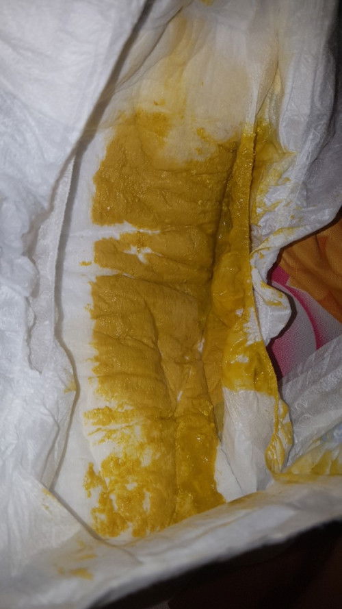 Mohon pencerahannya bun