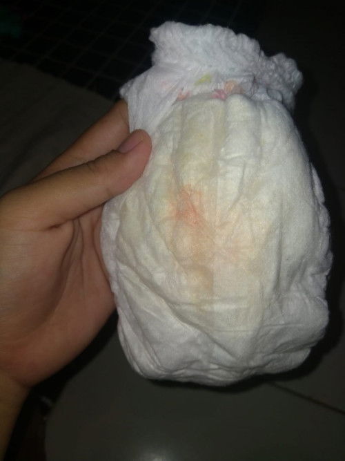 Bekas Pampers Bayi Usia 6.5 Bulan ada bercak Oren sampai merah