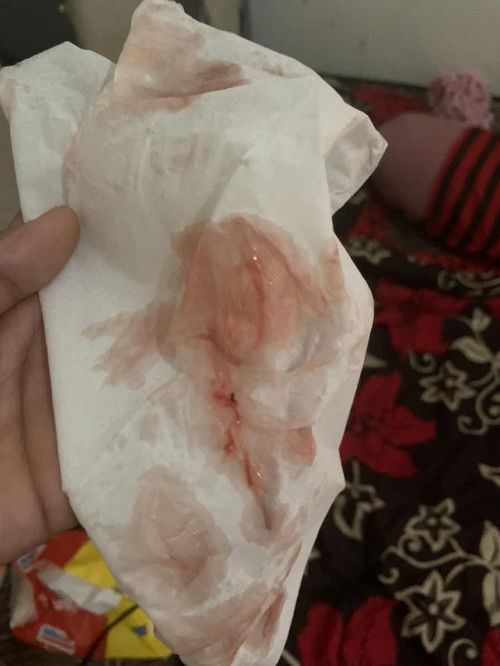 Keluar flek diusia kehamilan 39 minggu.