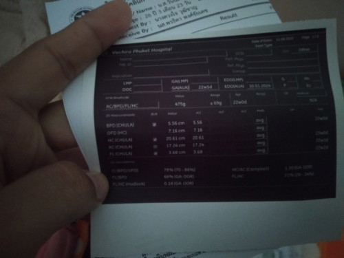 แผ่นอัลตร้าซาวด์