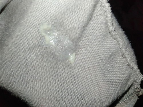 Keputihan hamil 27 week