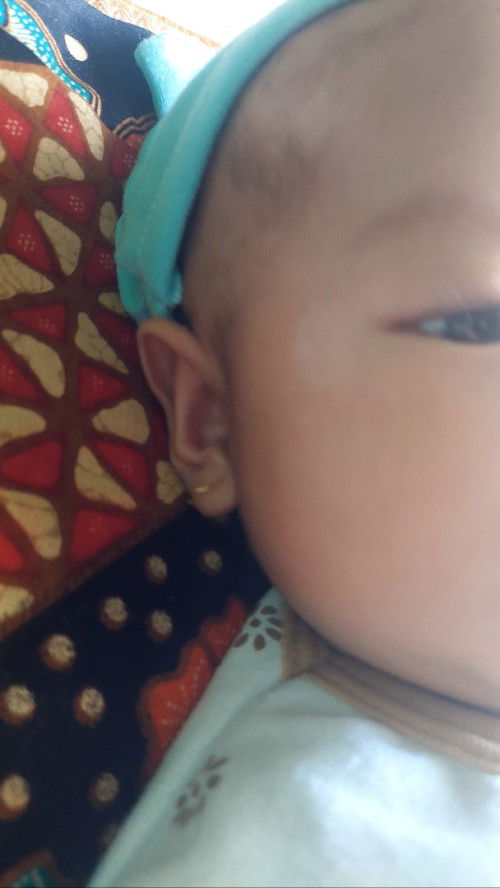 Putih" pda kulit usia 2bln