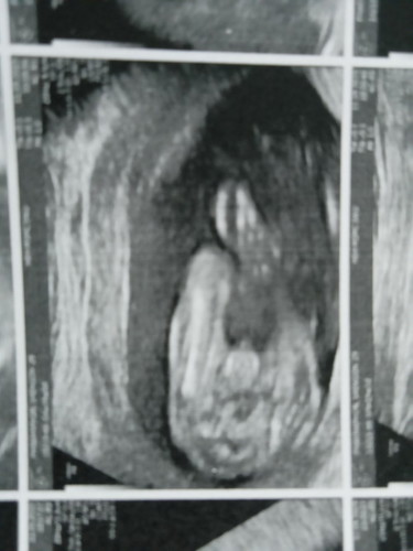 ทีมกุมภา67