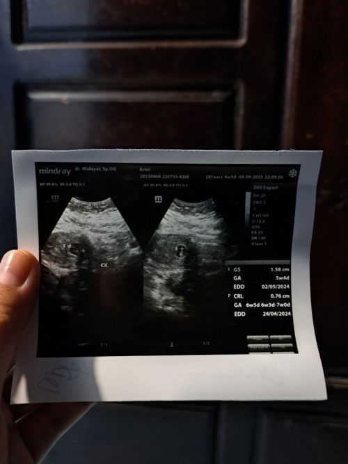 Keluar flek kecoklatan selama 1 minggu.