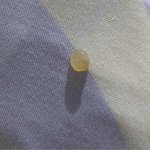 Sticky Discharge after giving birth Via Cs