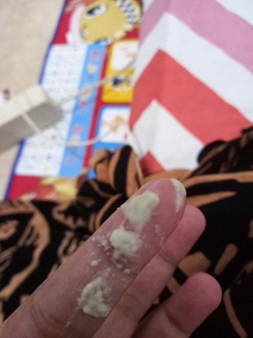 Disini ada gak yaa 28 weeks keputihan ampas tahu sampai pas HB anu paksu ikut gatal katanya. 😭