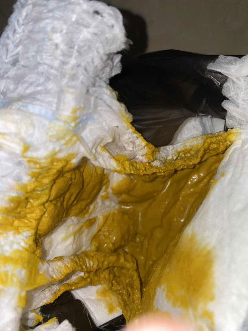 mohon maaf apakah diare