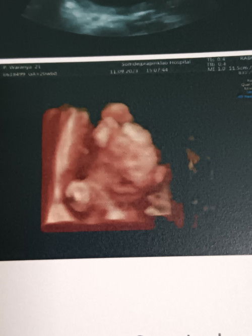 อัลตร้าซาวด์เจอปากแหว่งควรทำยังไงดีคะ