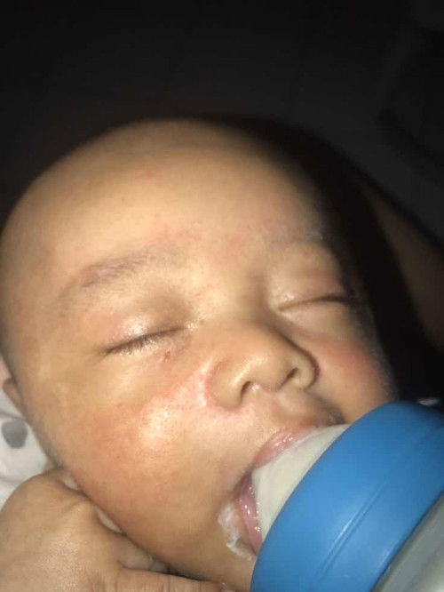 wajah bayi kaya ruam