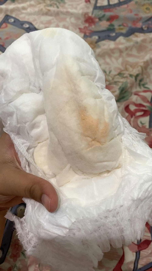 ciri isk pada bayi perempuan