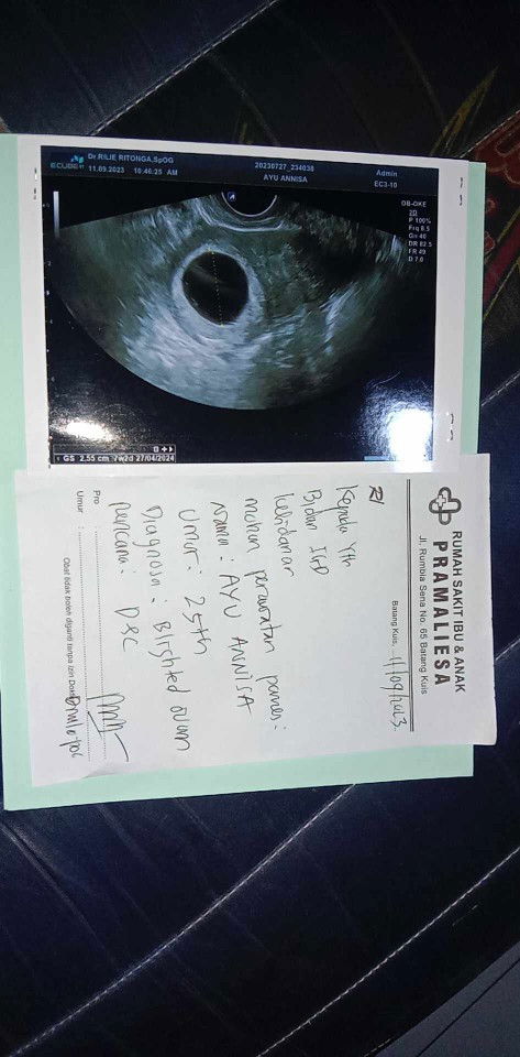 7minggu divonis bo dan disuruh kuret