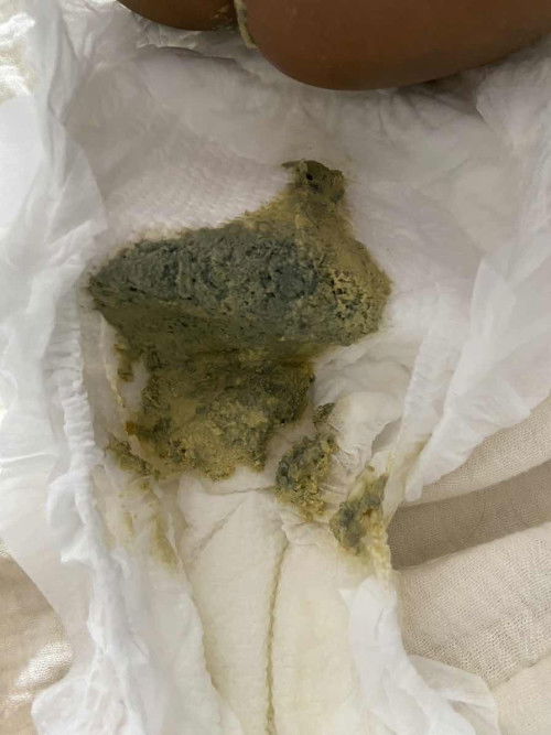 ลูกถ่ายเหลว/ติดเชื้อ