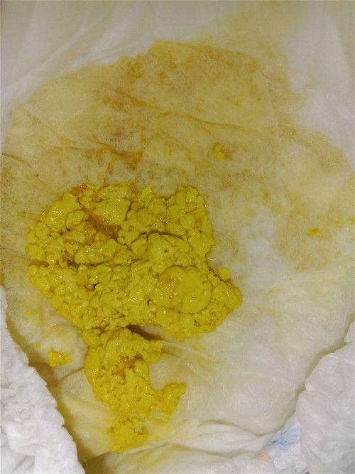 น้องถ่ายบ่อย