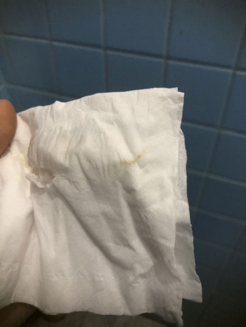 Ini flek, keputihan atau implantasi bun?