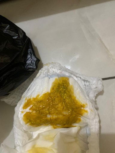bab bayi 2 bulan kuning dan berlendir