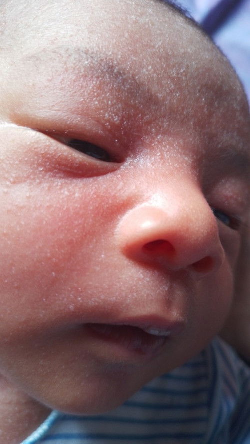 Bund ..tnya donk...kok kulit bayi ku kayk ini ya...baru umur 10 hari