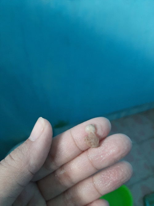 Lendir coklat 37 weeks