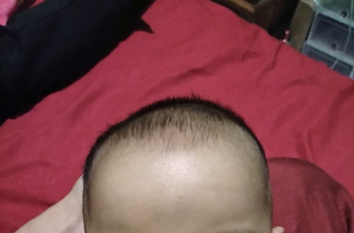 Atas kepala bayi tidak rata