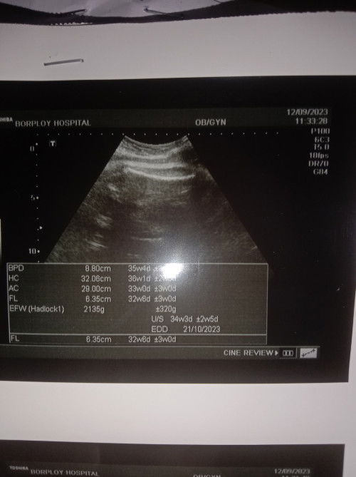 อายุครรภ์ตามใบอัลตร้าซาวด์