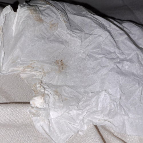 Keluar lendir coklat saat 35weeks