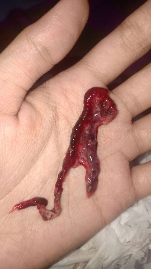 Akhirnya… keguguran 🥺 🥀