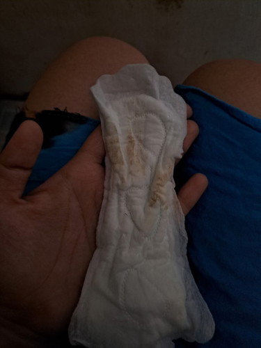 Keputihan atau flek?