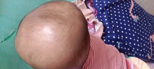 Rambut lebat