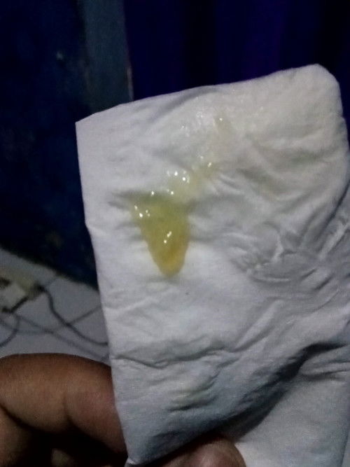 Maaf agak jorok, mau tanya itu lendir apa ya bun yg keluar dari V. Apa itu keputihan?