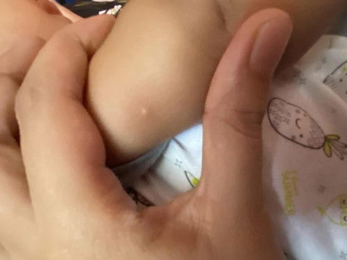 nak tanya bintik2 merah ni apa punca ye