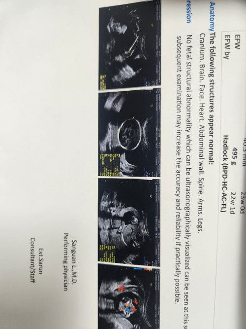 แม่มือใหม่ ลูกคนแรก