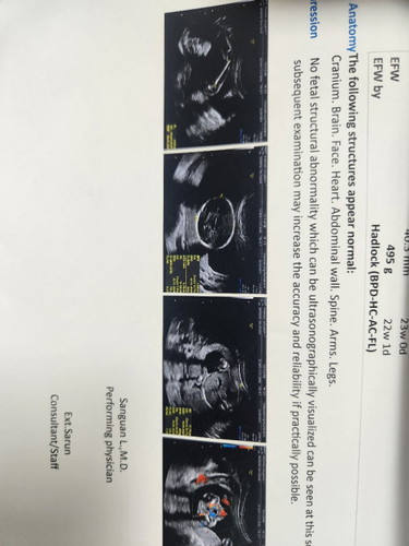 แม่มือใหม่ ลูกคนแรก