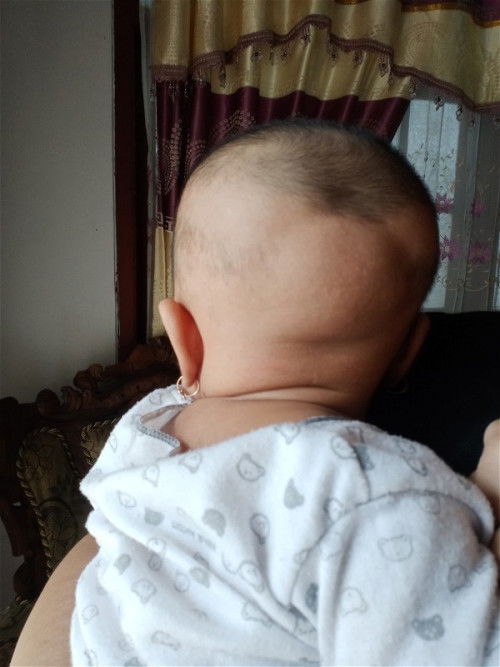 Bentuk kepala bayi 1 bulan 22 hari