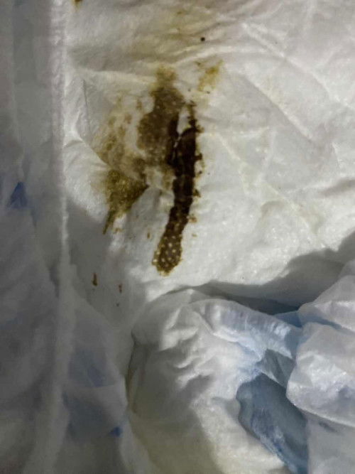 Bayi 1,5bulan pup nya sedikit