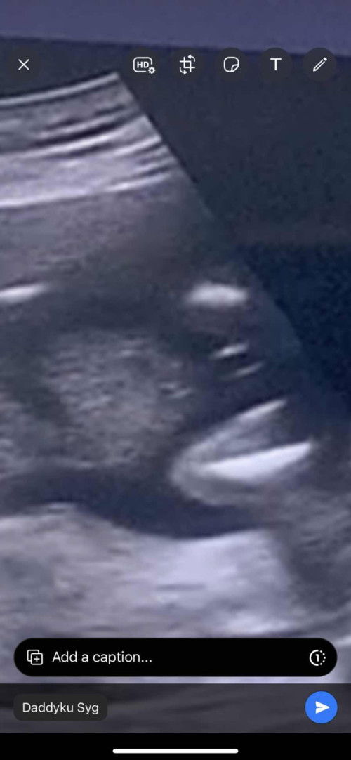 minta pandangan mata ibu2x