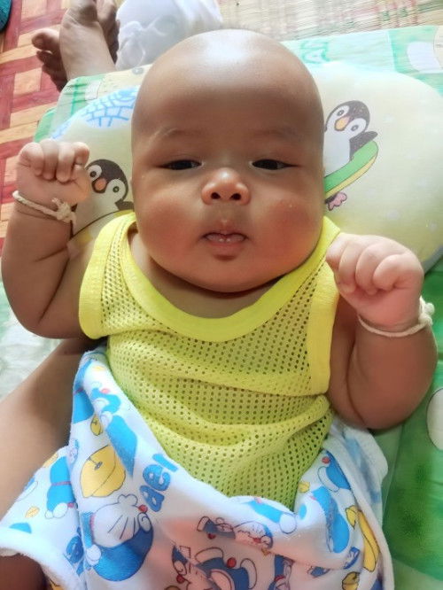 ขาหนีบเเดง เป็นเพราะสาเหตุใด 1เดือน22วัน