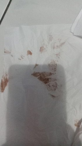 Maaf kalau jorok
Apakah wajar itu flek di usia kehamilan 11 Minggu 6hari ini
Apakah itu normal flek