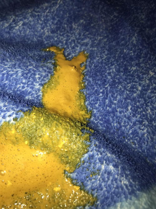 อึน้องผิดปกติมั้ย