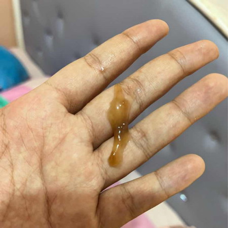 keluar lendir 38week