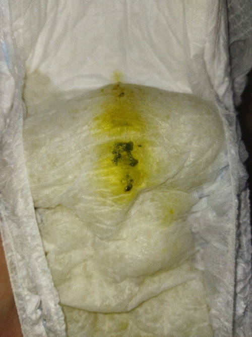 Bab bayi 2 bulan berwana hijau