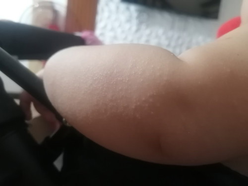 bungang araw?