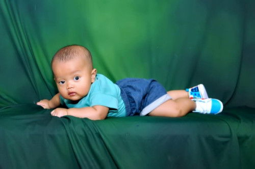 Halo bun mau tanya mata bayi sebelah sipit itu bisa kembali normal nggak ya ? Usia ssekarang4 bulan